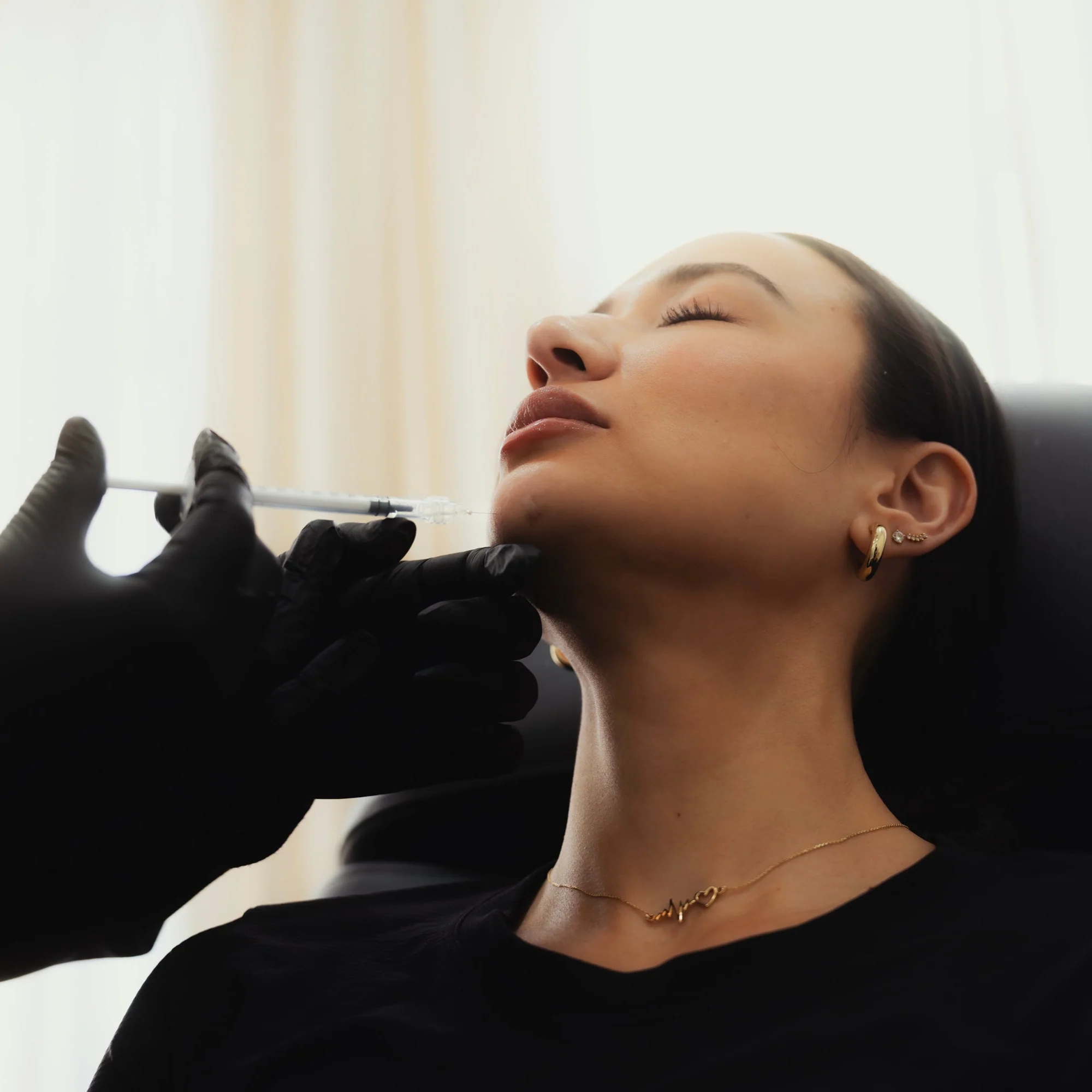 Chin Dimpling - Image 3