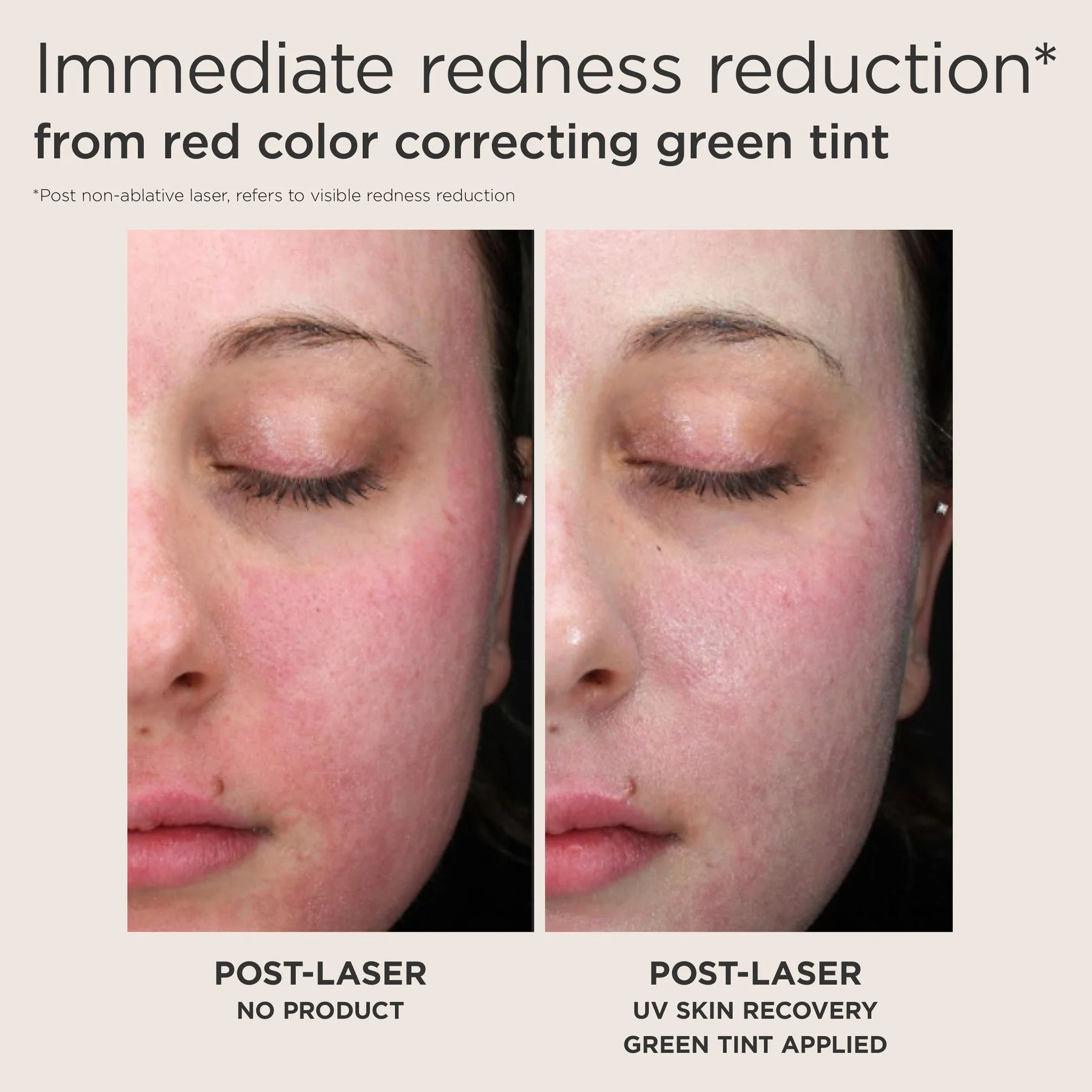 EltaMD UV Skin Recovery Green Tint - Image 3