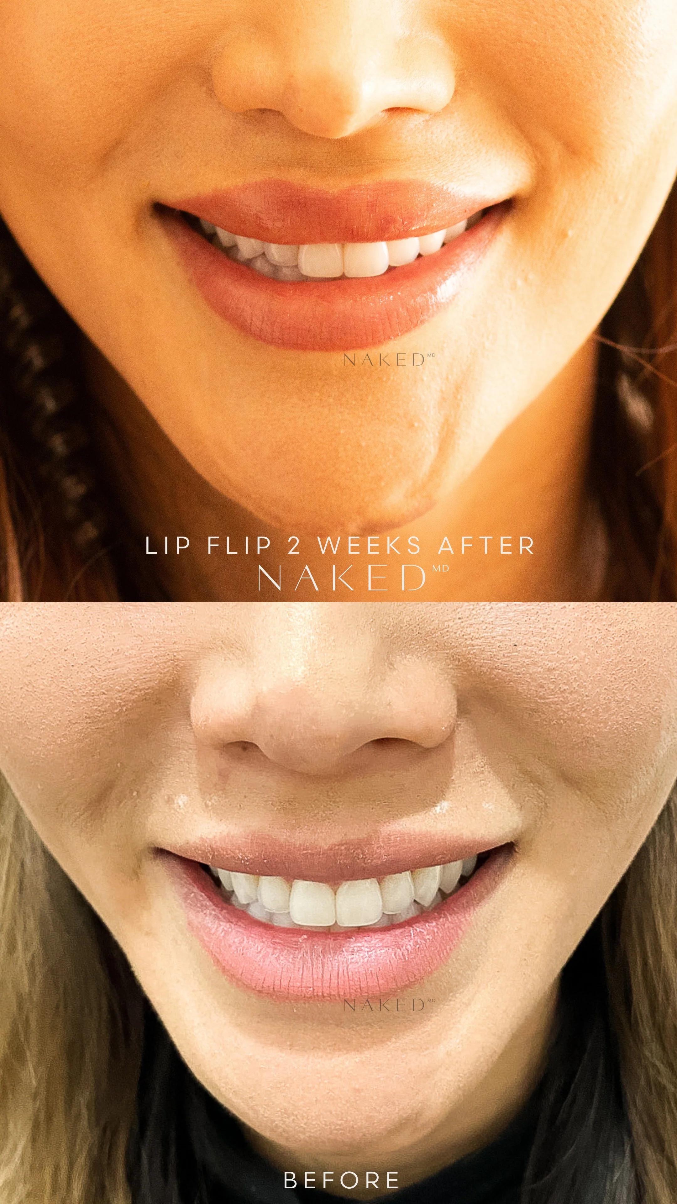 Lip Flip - Image 6