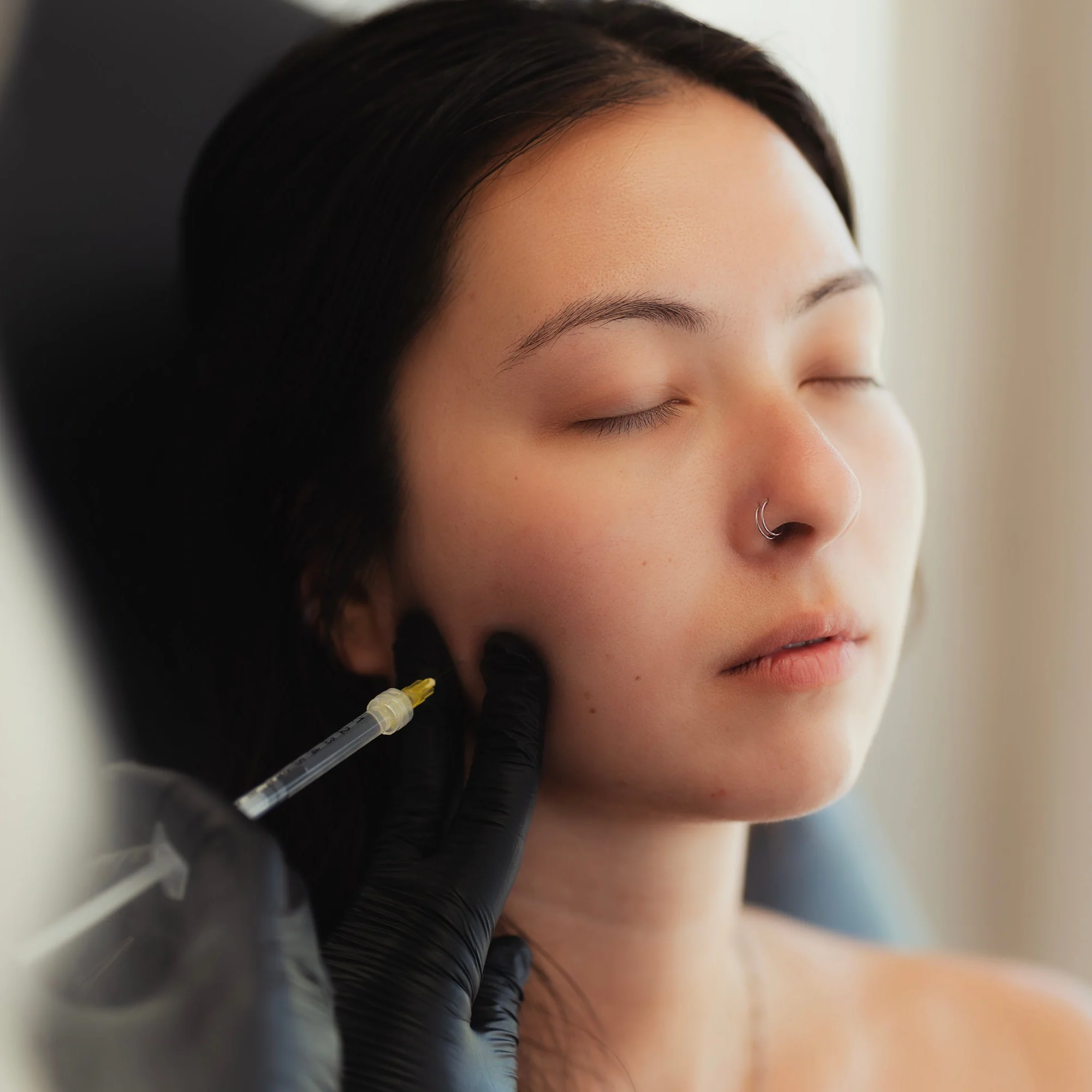 Masseter Reduction | TMJ - Image 3