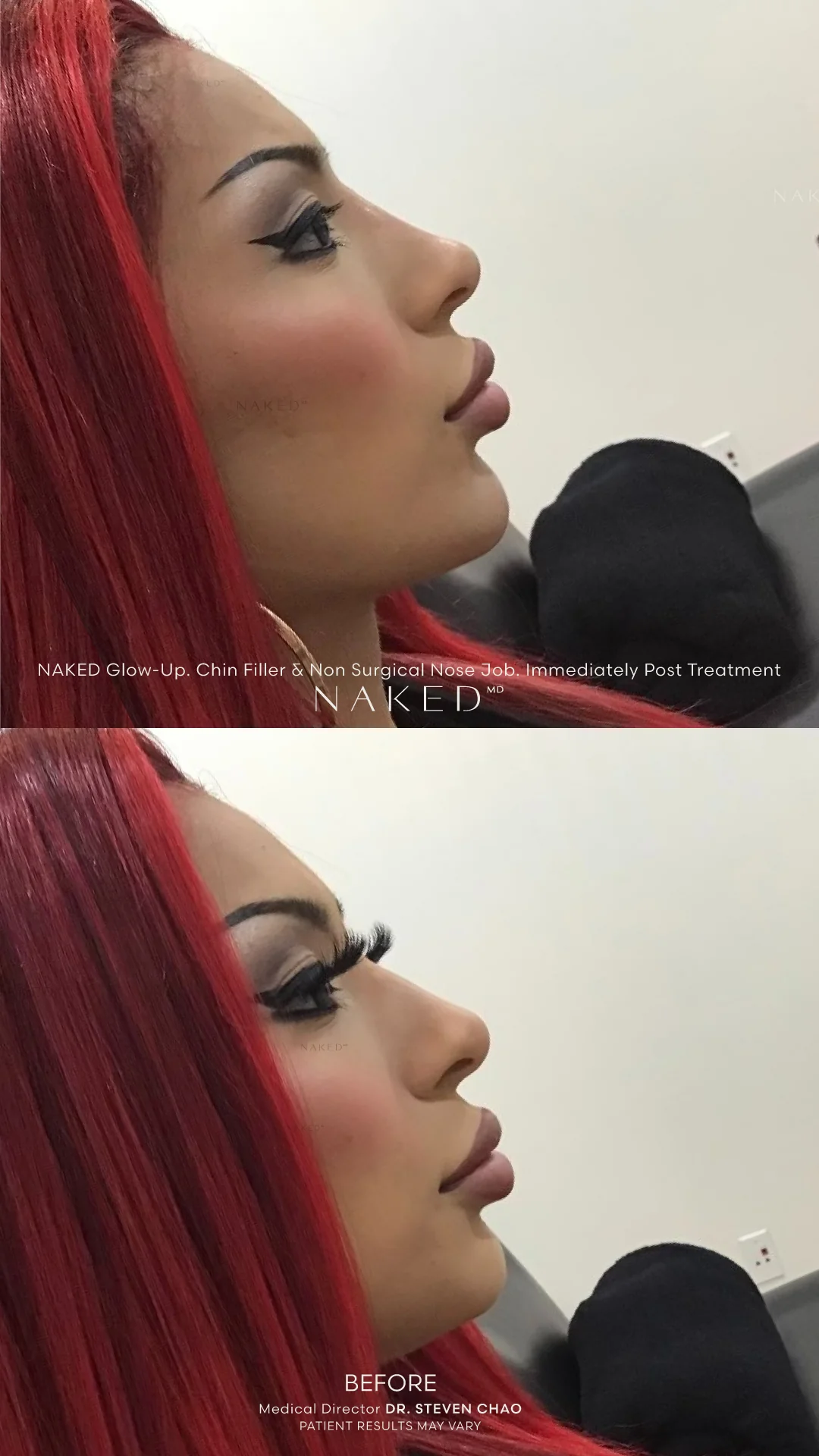 Naked Combo | Lips and Chin - Image 3