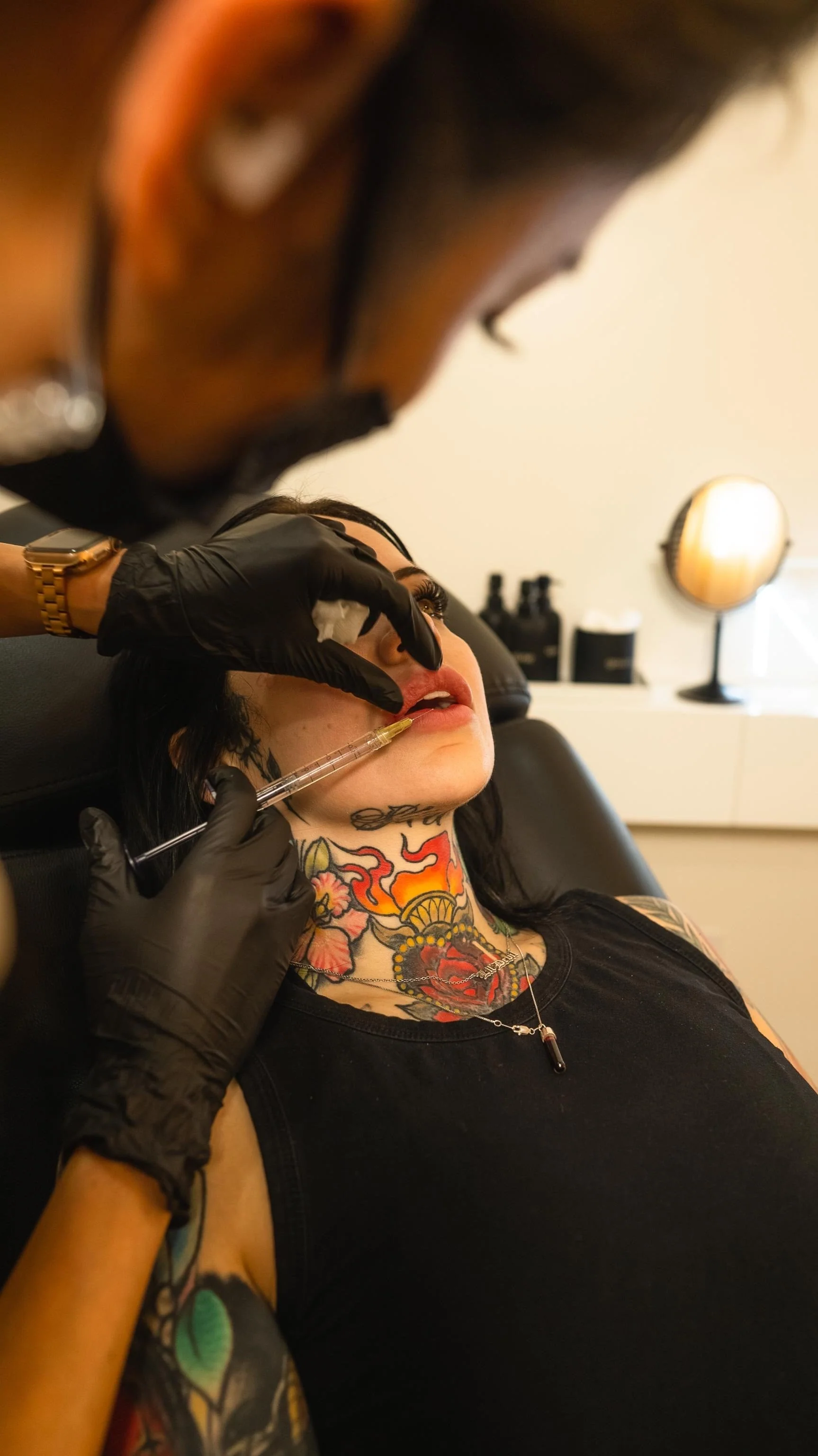 Lip Filler | New Client Offer - Image 49