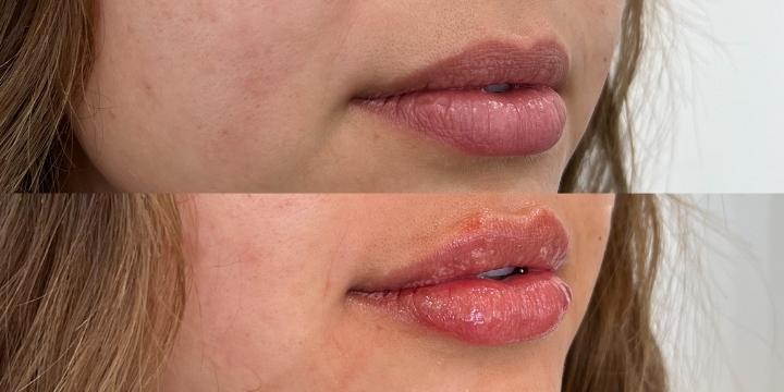 Naked Lips | Lip Filler - NV - Image 24