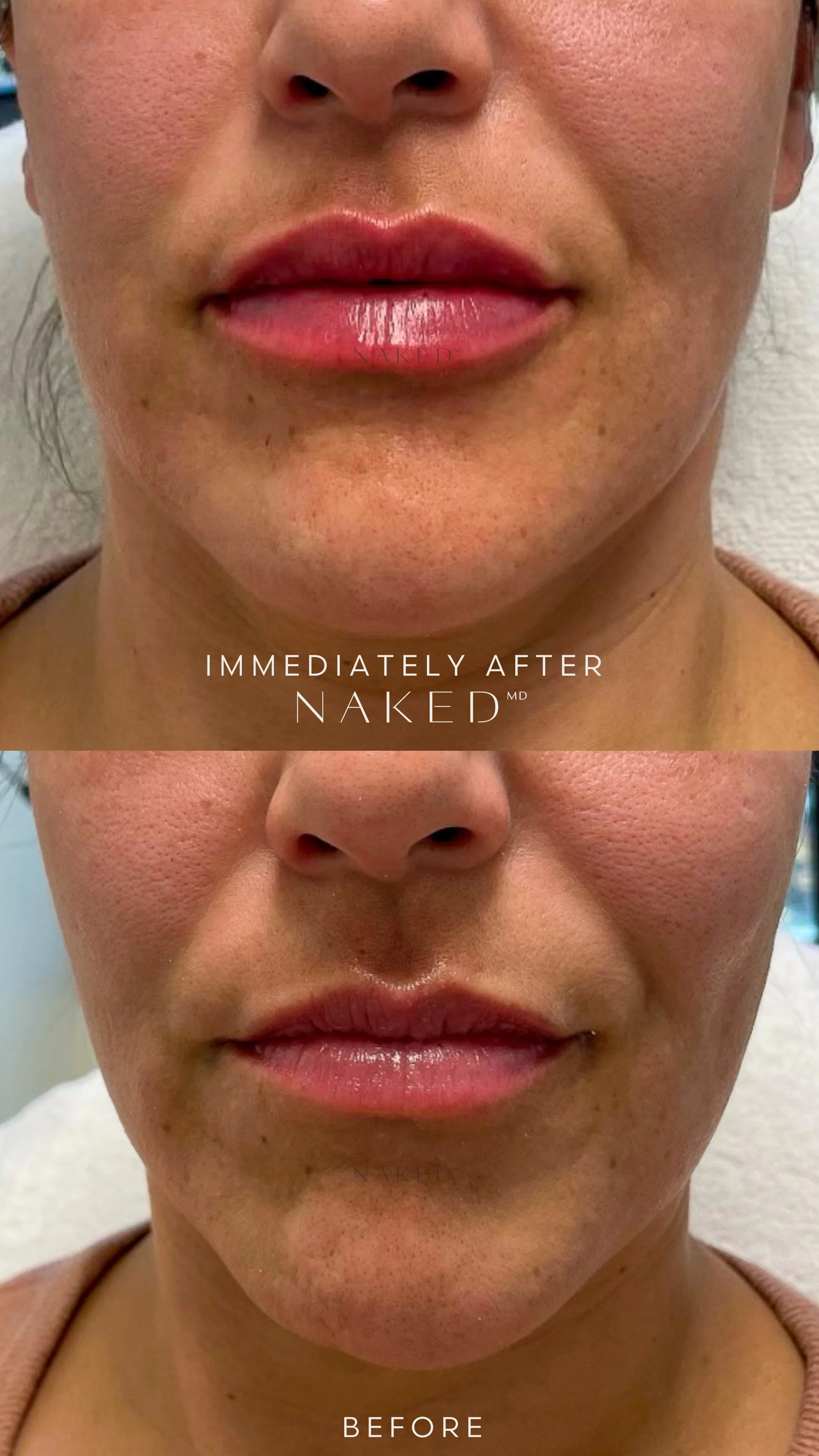 Naked Lips | Lip Filler - NV - Image 43