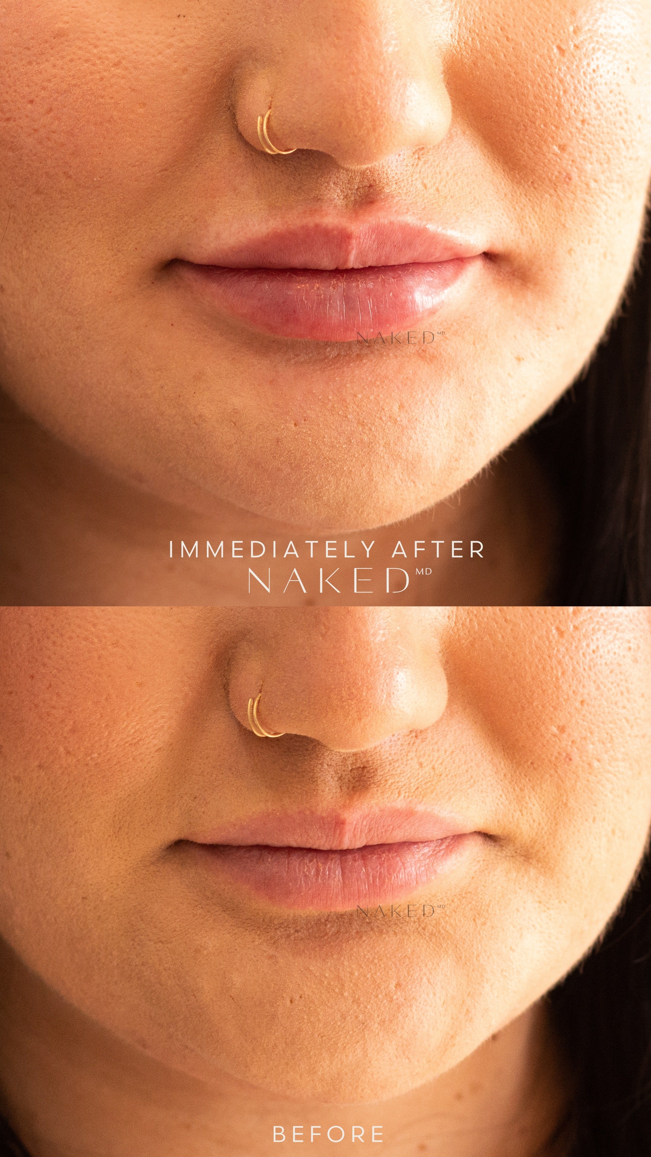 Naked Lips | Lip Filler - NV - Image 44