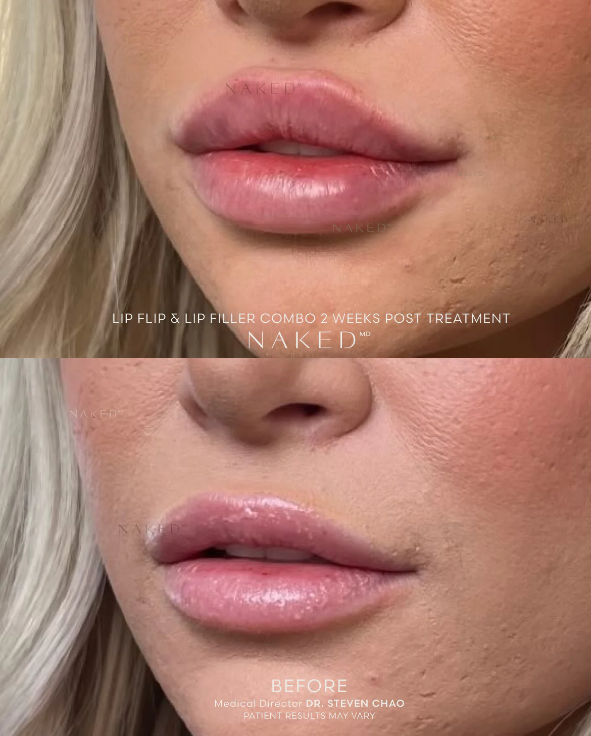 Naked Lips | Lip Filler - NV - Image 69