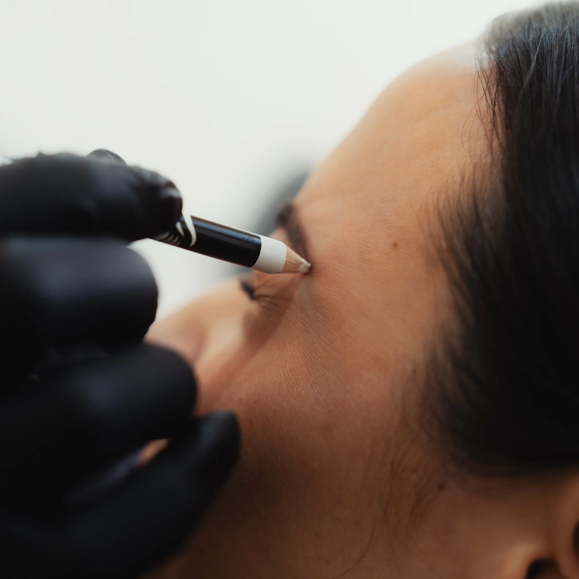 Non-Surgical Brow Lift - Image 3