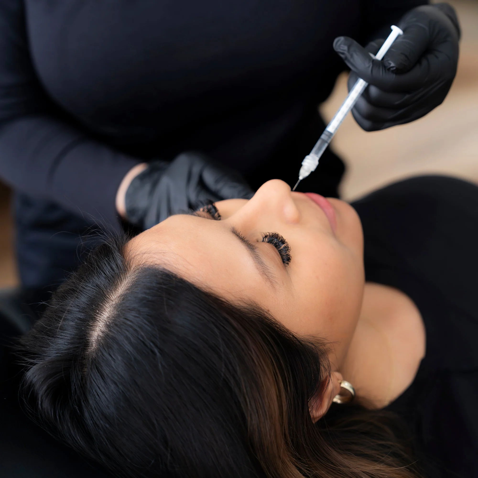 Nose Droop - Image 4