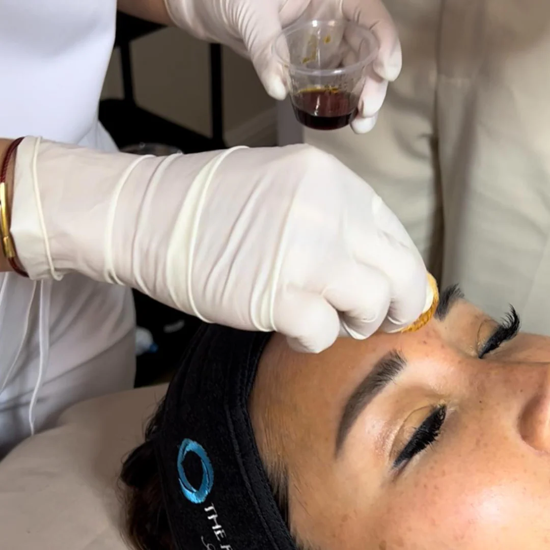 Perfect Derma Peel® - Image 4