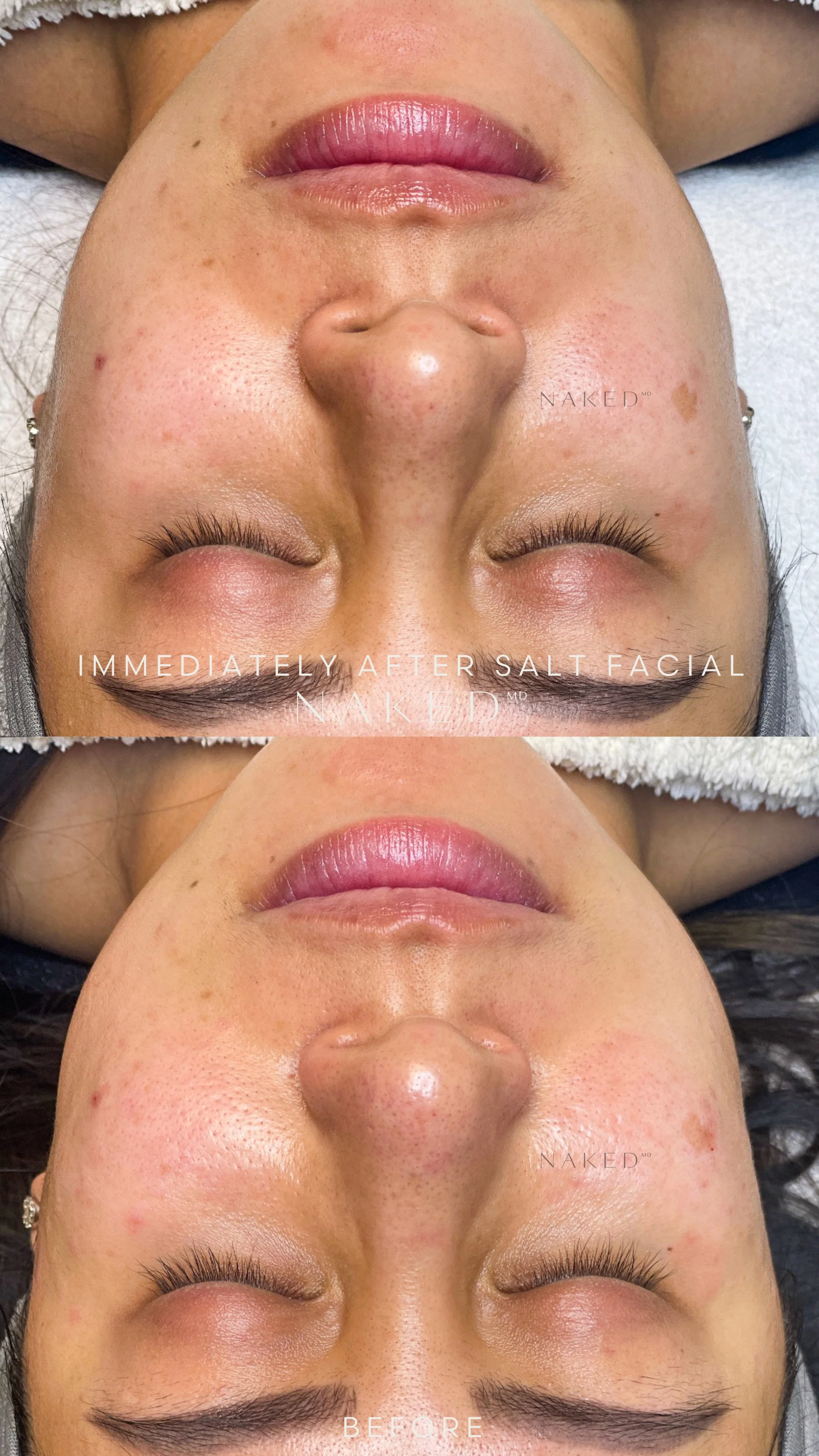 The SaltFacial® - Image 12