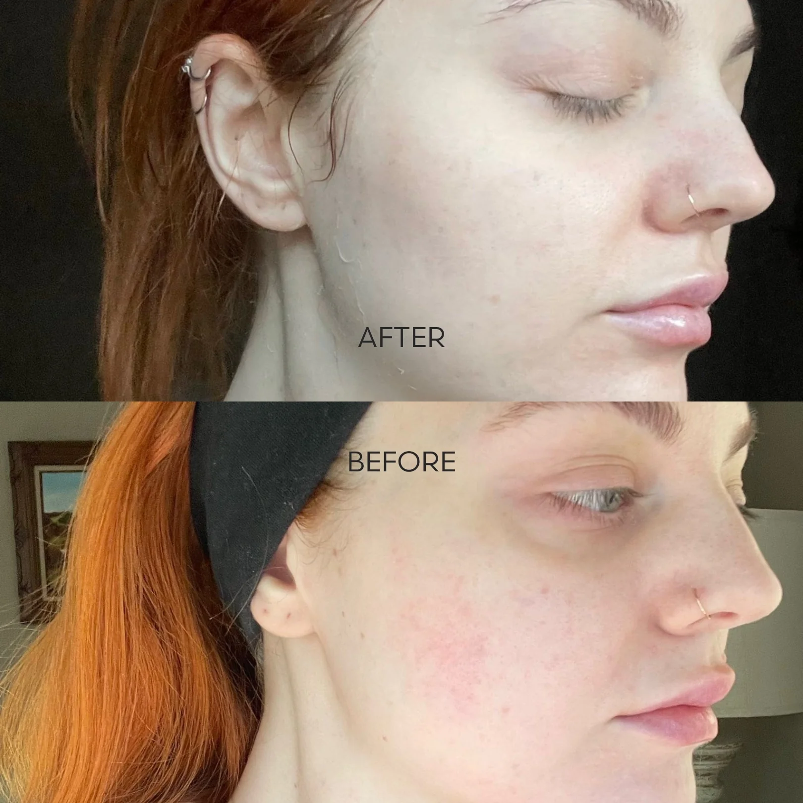 The Signature Peel - Image 3
