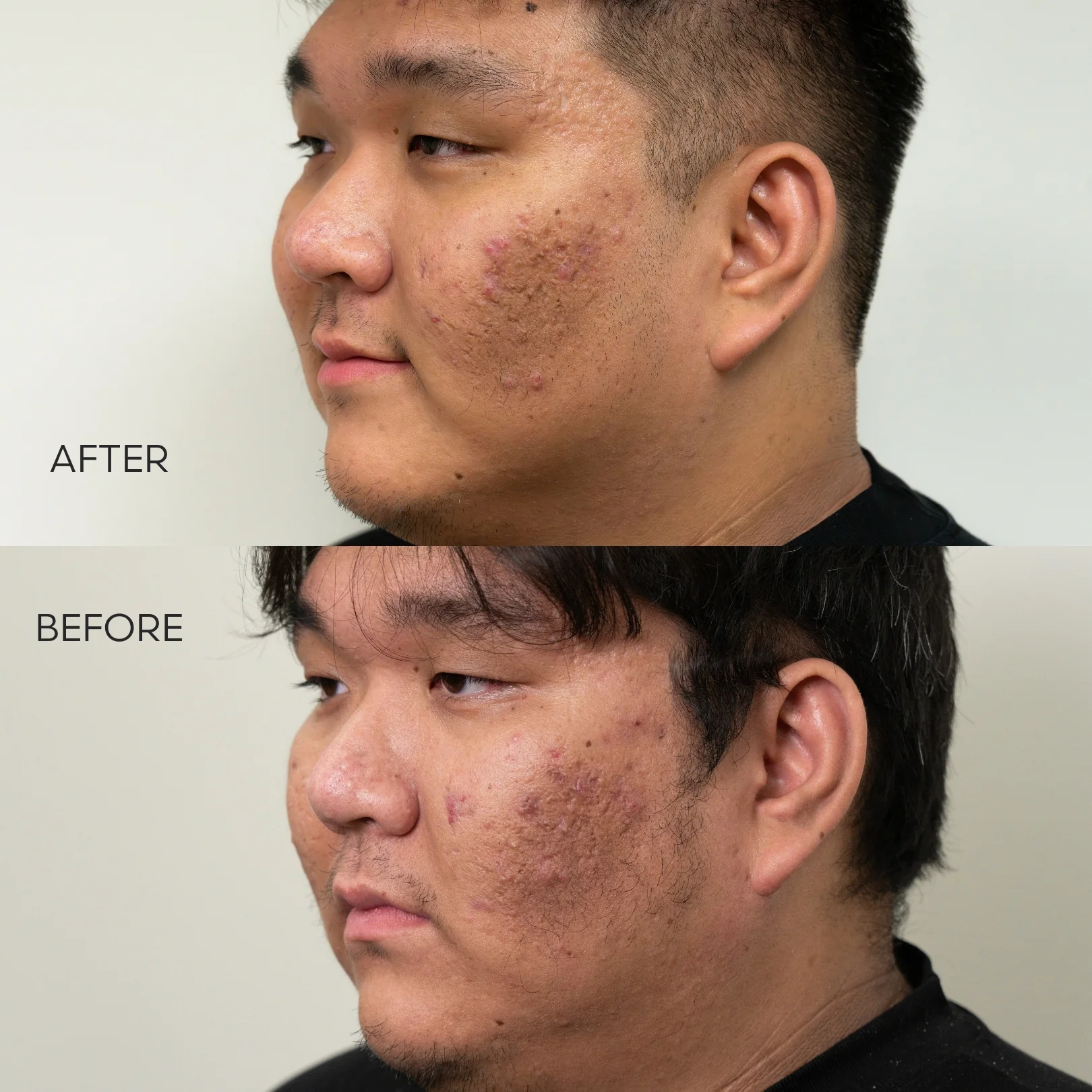 The Signature Peel - Image 5