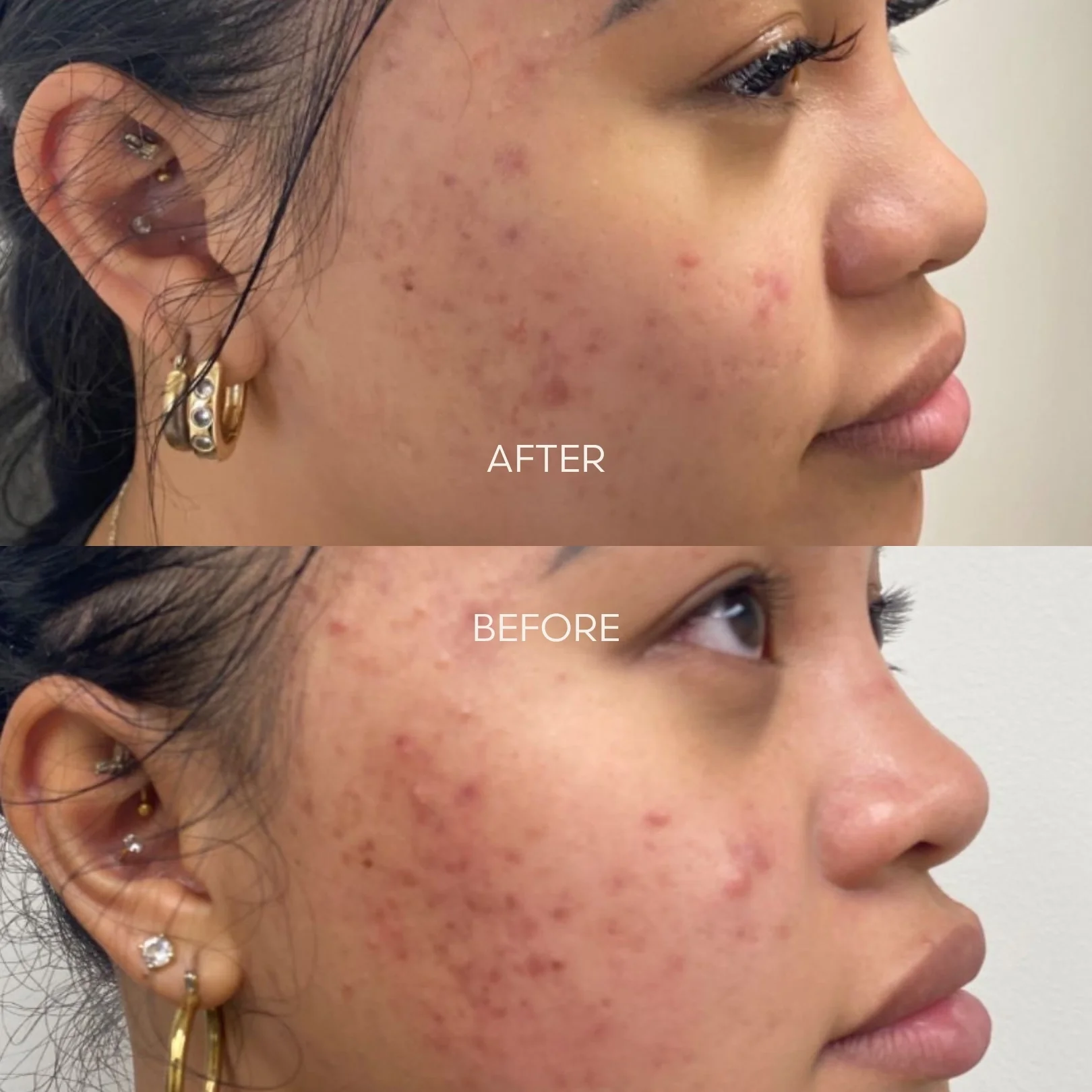 The Signature Peel - Image 6