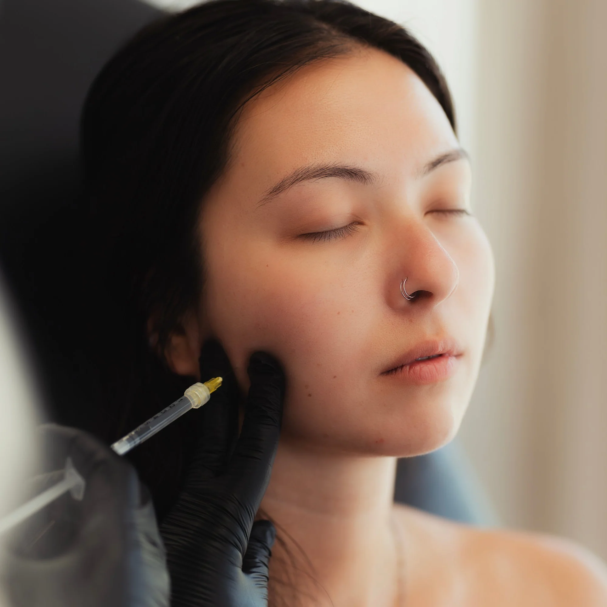 TOX | Slim Chin (Masseter) - Image 4