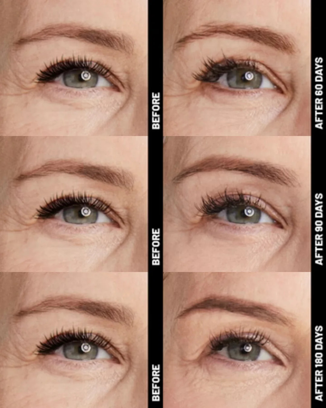 Ultherapy® | Non-Surgical Ultrasound Therapy - Image 13