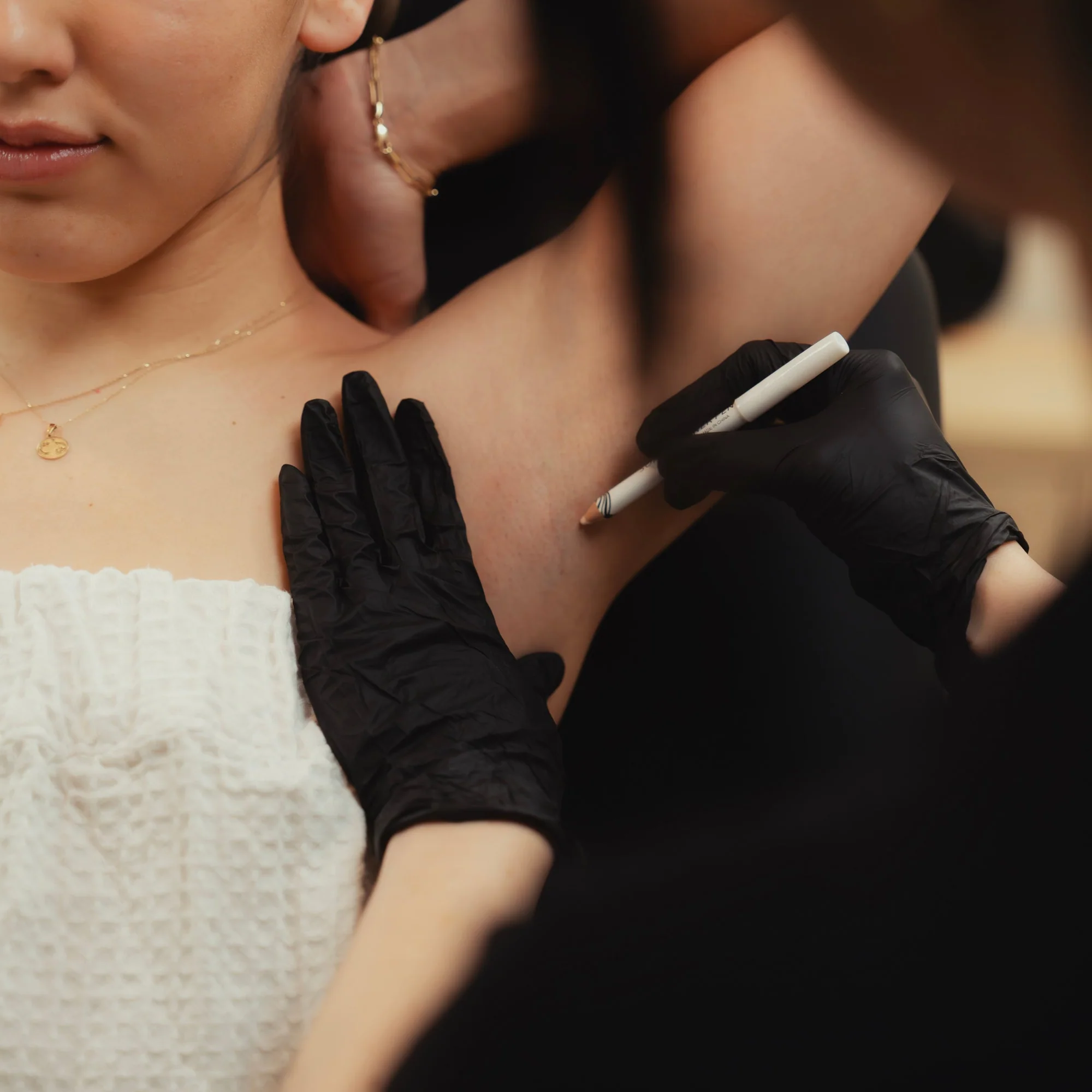 Underarm Sweating - Image 4